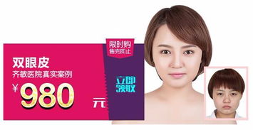 鞍山齊敏 980元雙眼皮手術，開啟美麗雙眸新篇章